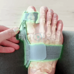 CORRECTOR DE JUANETES ORTOPEDICO